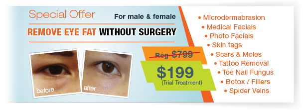 eye-fat-removal-offer