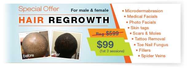 hair-regrowth-offer